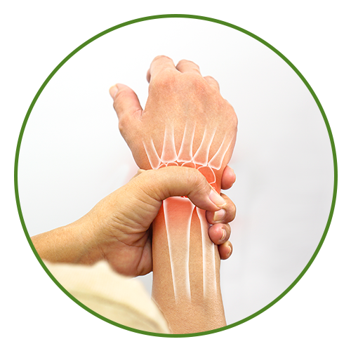 Arthritis