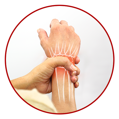 Arthritis