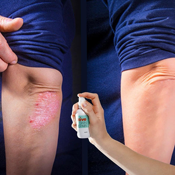 Buy from Active Skin Repair