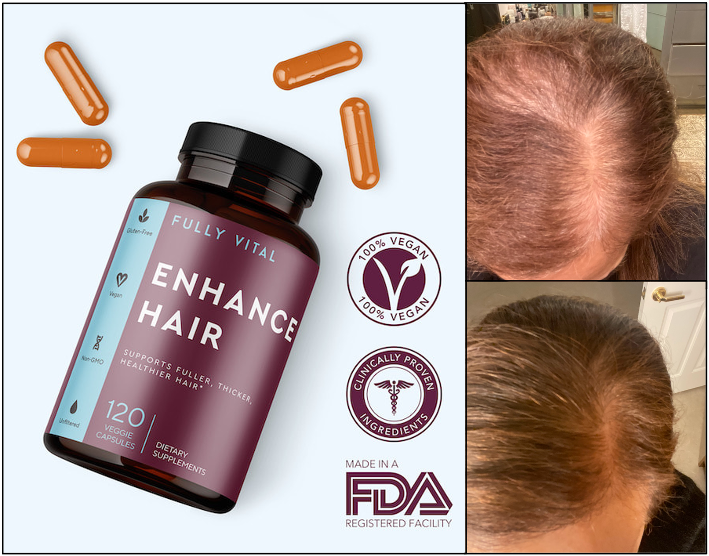 FullyVital: The powerful hair growth supplement that balances hormones and is 100% natural.