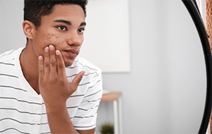 Young man examining his acne in a mirror.