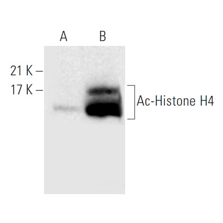 Trichtostatin A