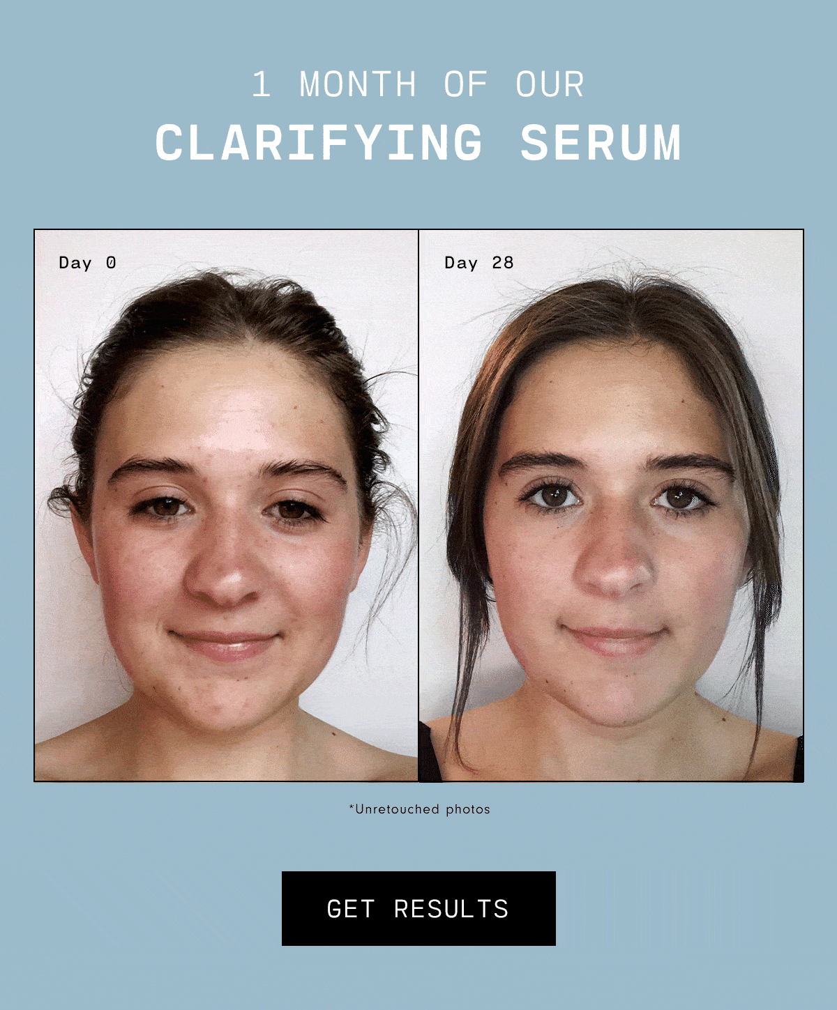 1 Month of Our Clarifying Serum