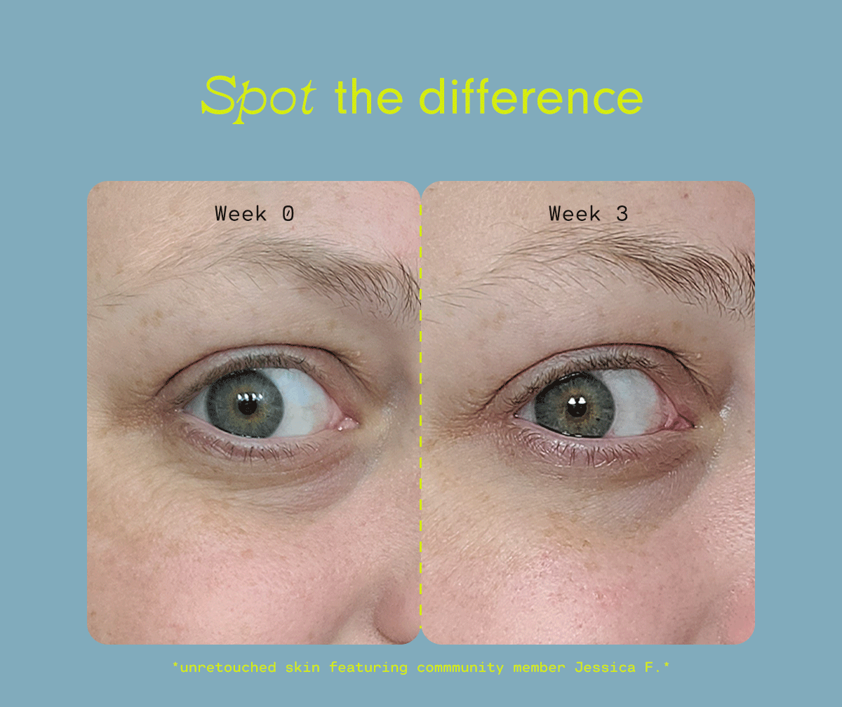 The Proof Is In The Before And After Photos Versed Skin 